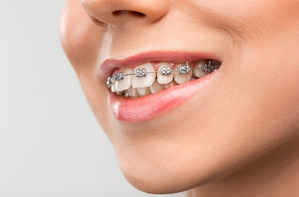 Dişsel ve İskeletsel Ortodontik Bozuklukların Tedavisi